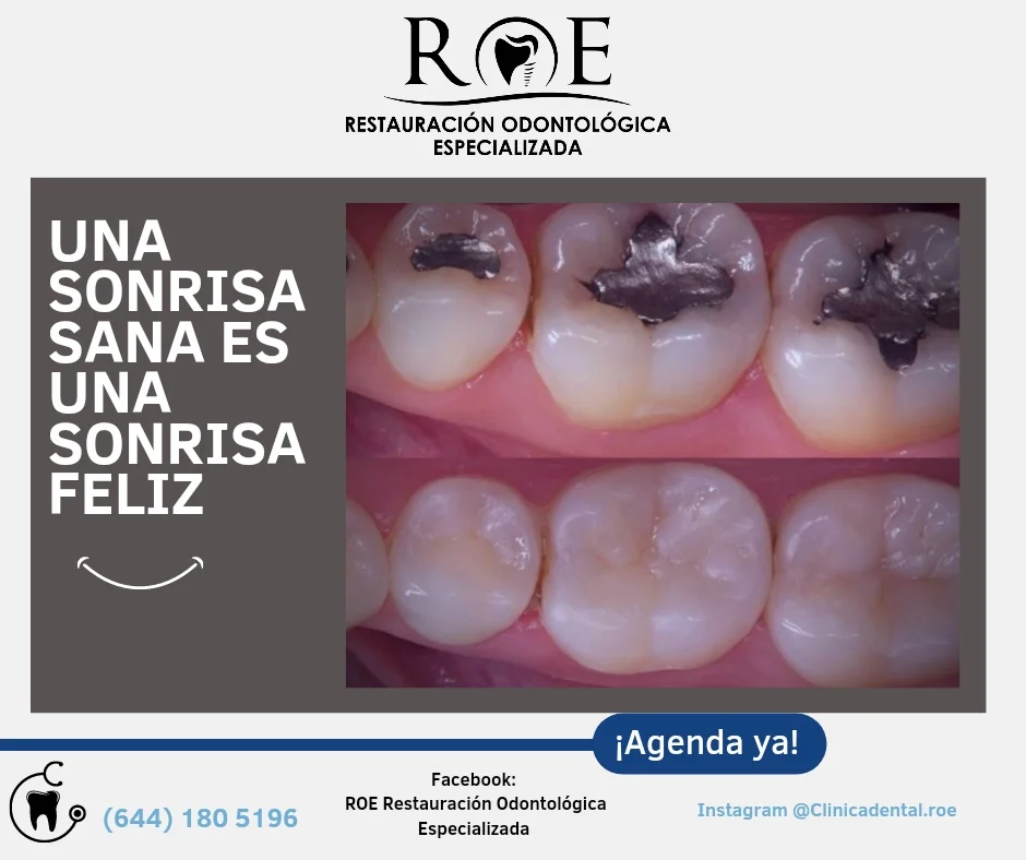 Resultado estético de tratamiento dental en Clínica Dental ROE