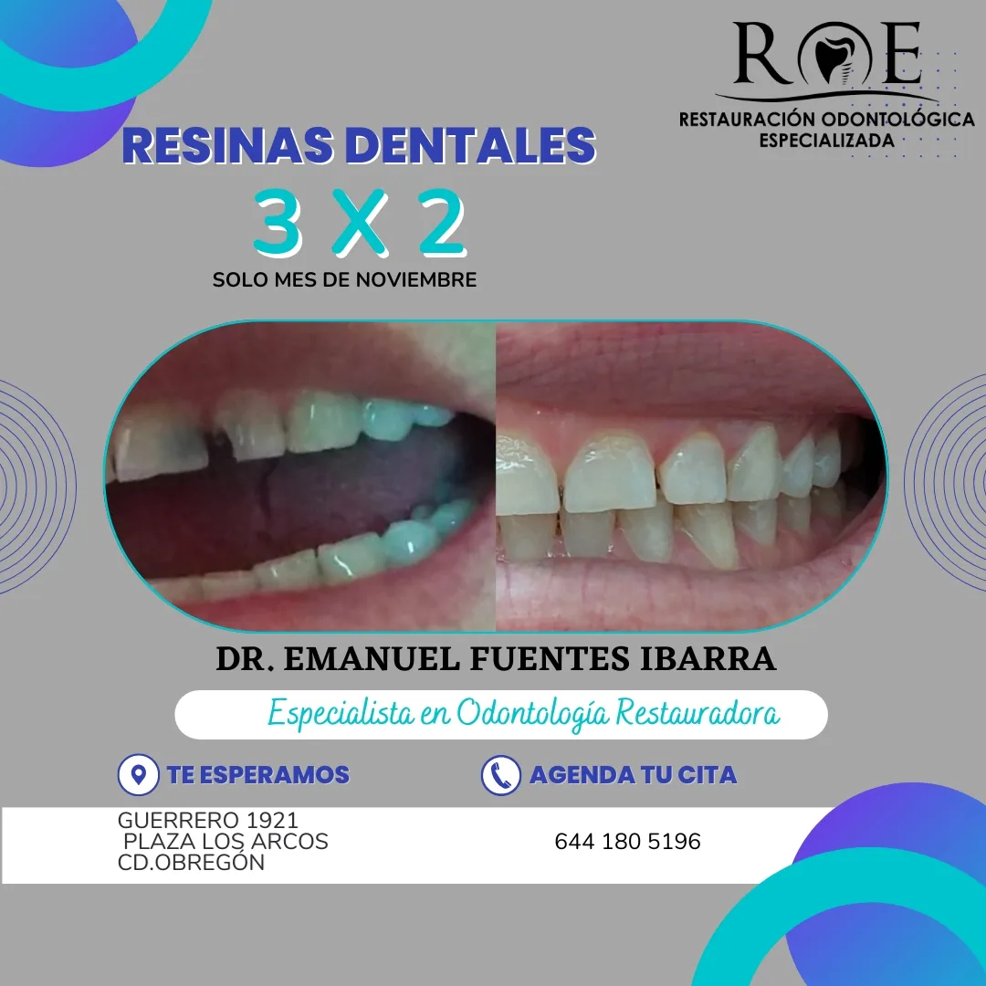 Caso de diseño de sonrisa en Clínica Dental ROE