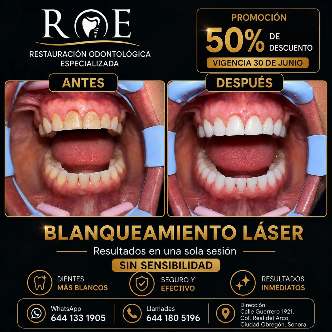 Resultado de diseño de sonrisa en Clínica Dental ROE