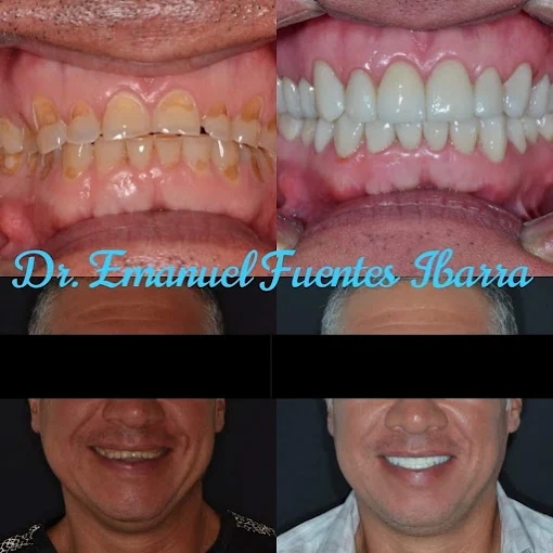 Caso de rehabilitación estética en Clínica Dental ROE